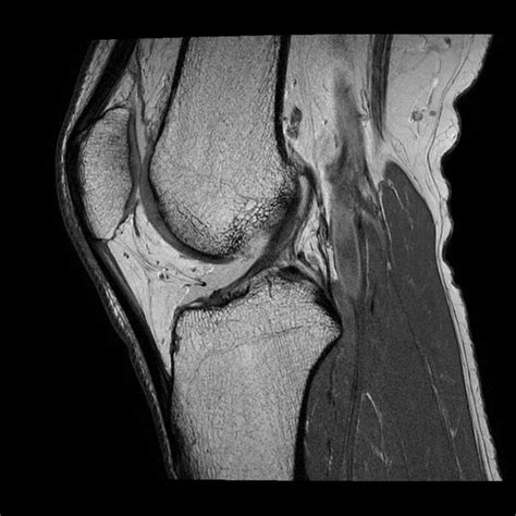 Knee MRI | AffordableMRI.com