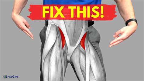 How to Relieve Hip Flexor Pain in 30 SECONDS | SpineCare