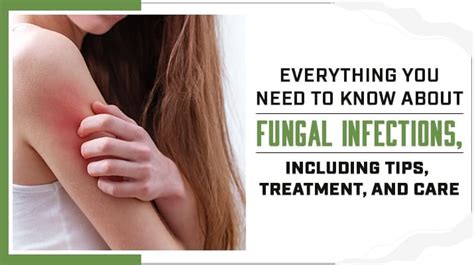 Everything You Need to Know About Fungal Infections, Including Tips ...