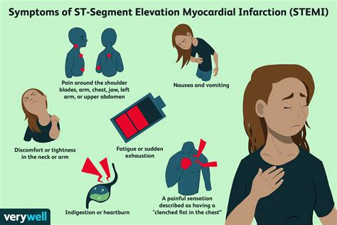 STEMI Heart Attacks and Why They Are So Dangerous