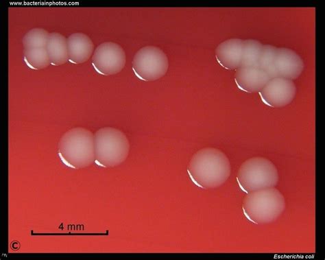 Pin on Microbiology