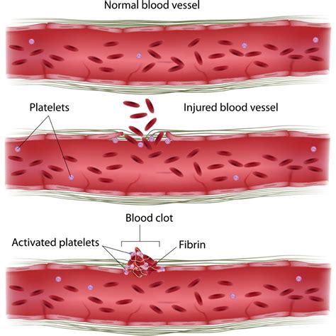 Blood Clotting - Anatomy Ch. 10: Blood