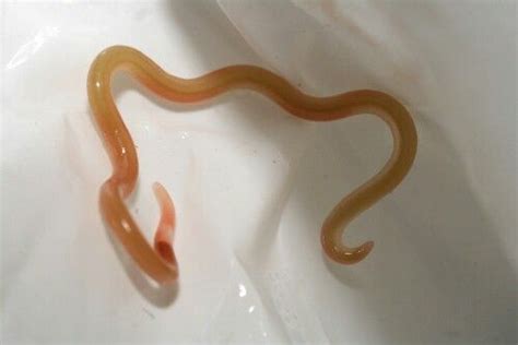 Roundworms are in the phylum Nematoda. They are the most common worms ...