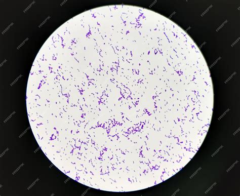 Gram Stain Staphylococcus Aureus