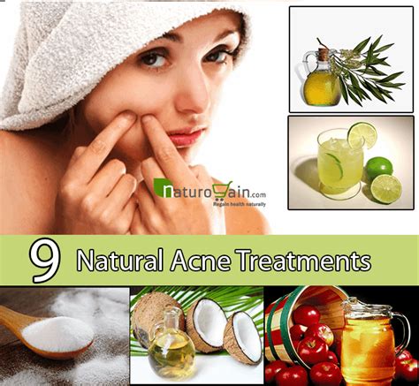 Natural Acne Treatment - Treat Acne with These 9 Natural Cures