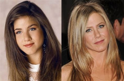 Jennifer Aniston before and after nose job photos | Jennifer aniston ...