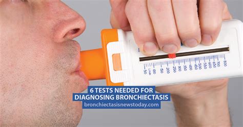 6 Tests Needed for Diagnosing Bronchiectasis - Bronchiectasis News Today