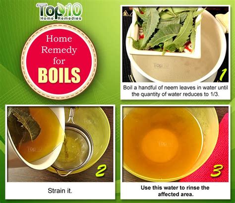 Home Remedies for Boils and Abscesses | Top 10 Home Remedies