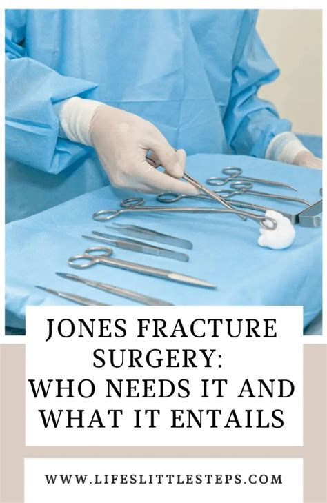 Jones Fracture Surgery: Who Needs It and What It Entails