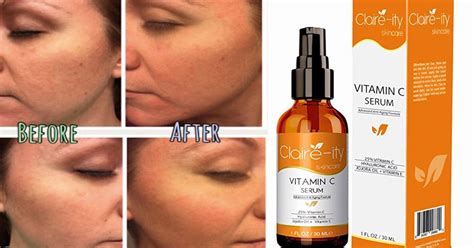 This Vitamin C Serum Might Be The Best Thing To Ever Happen To Your Skin