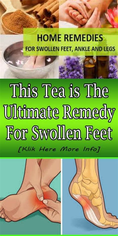 swollen feet after delivery remedy - Enshrinement Blogger Photo Galleries