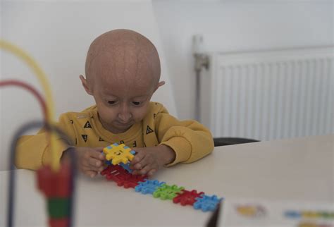 Progeria Therapy