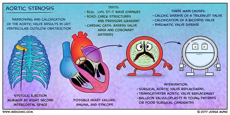 "Aortic Stenosis" by Medcomic | Redbubble