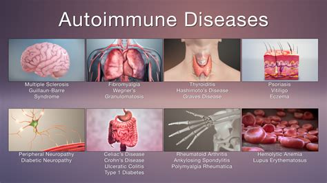 Autoimmune Diseases: Symptoms and Treatments - Scientific animations