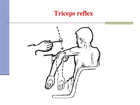 PPT - Electromyography (EMG) PowerPoint Presentation, free download ...