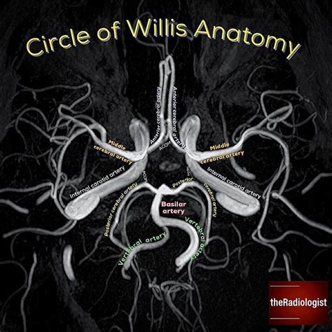 👨🏽‍💻Need a refresher on Circle of Willis anatomy? Check out this image ...