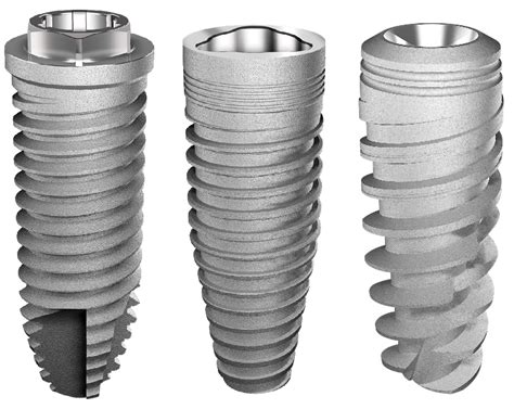 JCM | Free Full-Text | Impact of Different Titanium Implant Thread ...