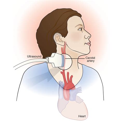 Ultrasound of carotid artery | Battista Illustration