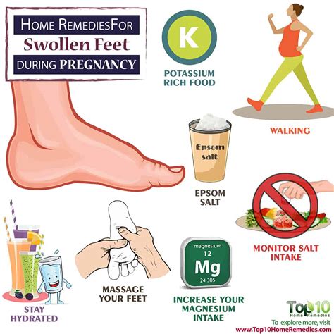 Home Remedies for Swollen Feet during Pregnancy | Top 10 Home Remedies