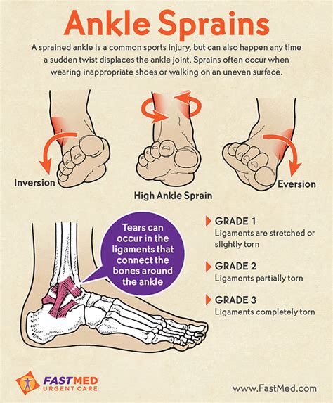 Do I Have A Sprained Ankle? [INFOGRAPHIC]