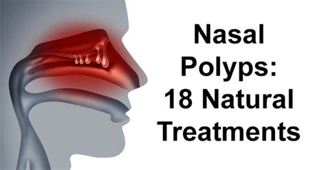 Nasal Polyps: 18 Natural Treatments - David Avocado Wolfe