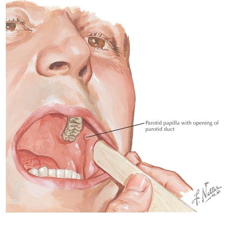 13: Oral Cavity | Pocket Dentistry