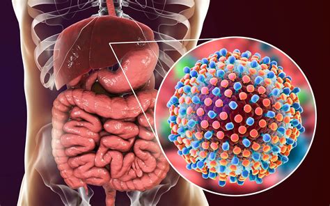 Early Treatment for HCV Infection Provides Benefits Beyond Liver ...