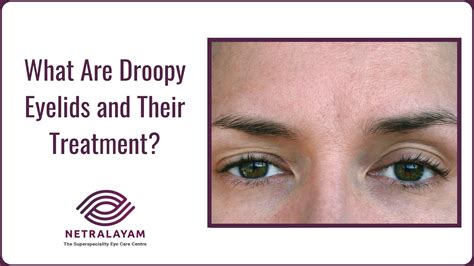 What Are Droopy Eyelids and Their Treatment?