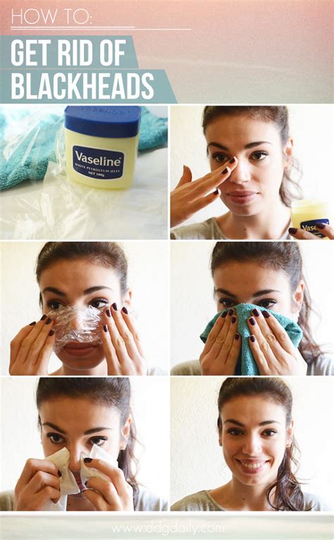 Efficient Blackheads Removing Method - AllDayChic