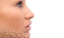 5 Reasons the Skin on Your Face Might Be Peeling | HowStuffWorks