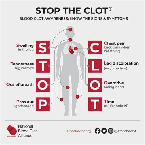 Does Dvt Pain Hurt All The Time? Exploring Discomfort In Deep Vein ...