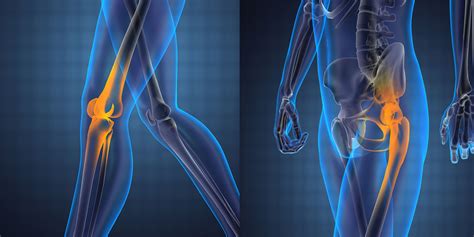 Knee And Hip Replacement - Orthopedic Surgeon Monmouth County NJ ...