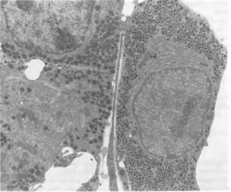 15 questions with answers in PITUITARY GLAND | Science topic