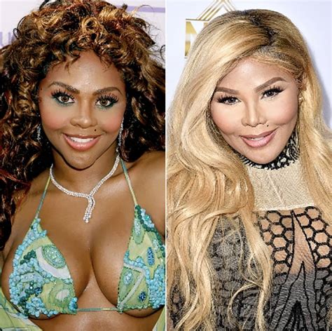 Botched! 10 Plastic Surgery Fails That Ruined Celebrities | Factionary