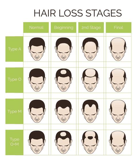 Mature hairline age – Telegraph