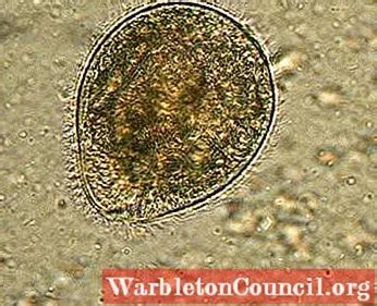 BALANTIDIUM COLI: CHARACTERISTICS, LIFE CYCLE, MORPHOLOGY - SCIENCE