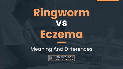 Ringworm vs Eczema: Meaning And Differences