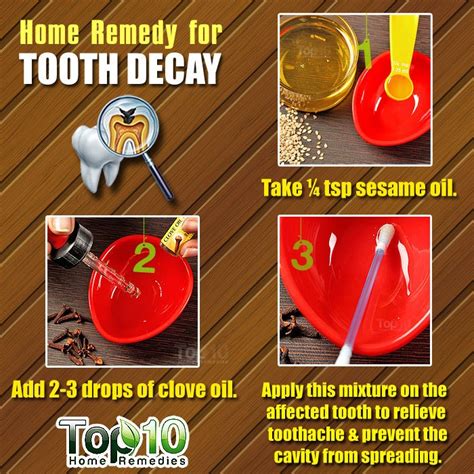 Home Remedies for Tooth Decay and Cavities | Top 10 Home Remedies