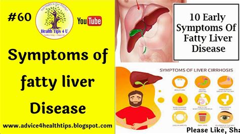 10 Symptoms Of Fatty Liver Disease Facty Health