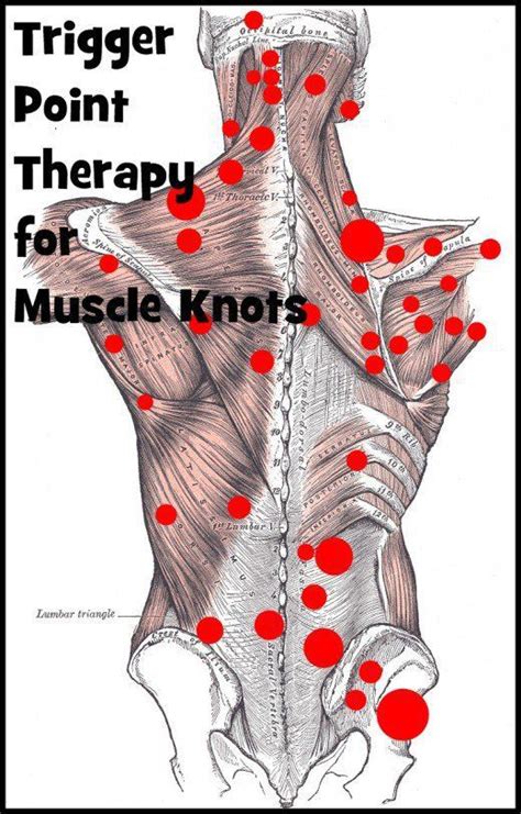 Trigger Point Therapy for Muscle Knots hip flexor trigger point ...