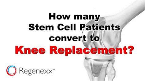 Knee Replacement After Stem Cell Treatment: How Often Does It Happen ...