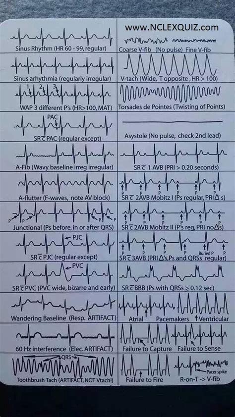 EKG Heart Rhythms Cheat Sheet #nursing | Nursing school survival, Icu ...