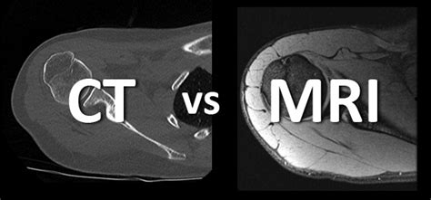 What's the difference between an MRI and CT? - Cincinnati Children's Blog