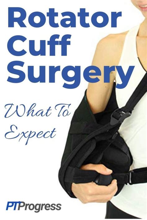 Rotator Cuff Surgery: What to Expect After Rotator Cuff Repair ...