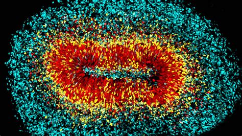 SciShots: Mini-brains - Allen Institute