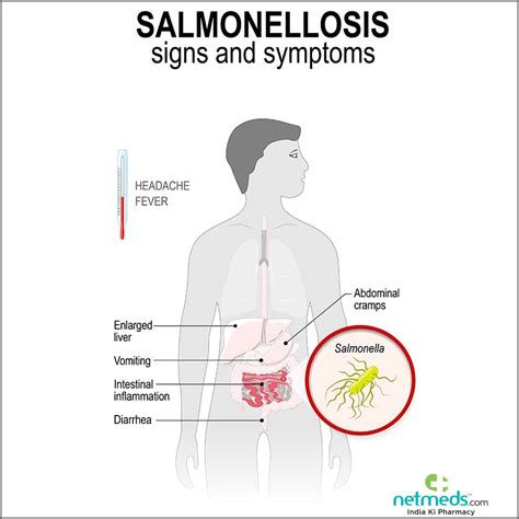 Salmonellosis: Causes, Symptoms And Treatment | Netmeds