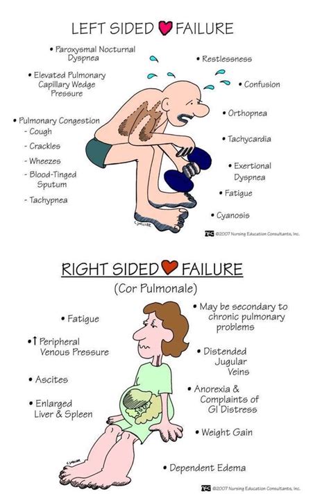 Cardiac Failure | Nurse, Nursing school survival, Nursing students