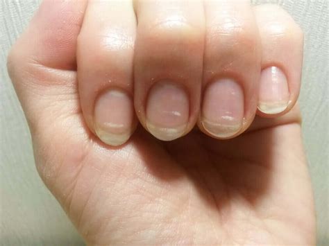 What the Lunula of Your Nails Says about Your Health