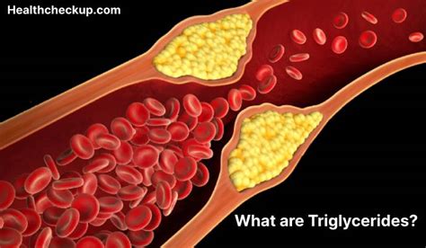 Triglycerides - High, Low, Normal Range