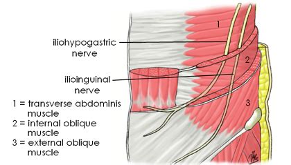 Ilioinguinal Nerve Dermatome